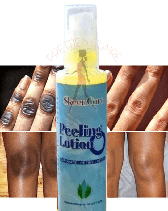 SKEENCARE PEELING LOTION 120ML